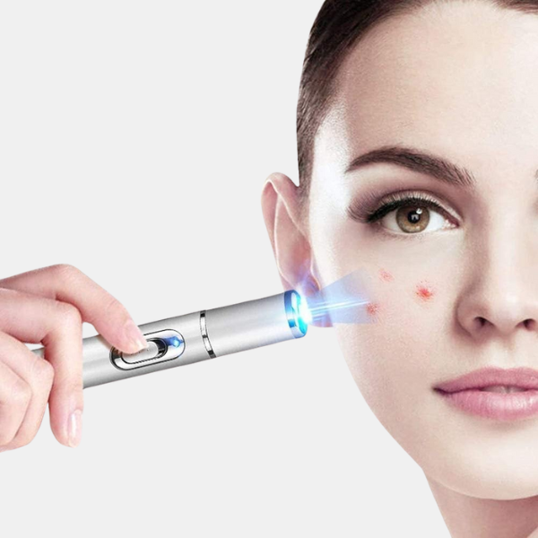Blåt lysterapi-laserpen – Målrettet lindring af åreknuder og forbedret blodcirkulation Massage & Relaxation Tech Butik